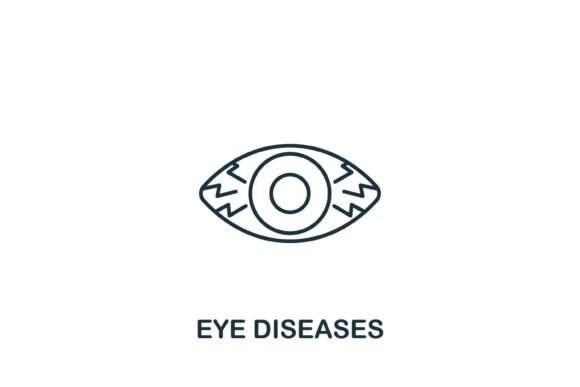 Eye Diseases Icon: A Clean, Modern Graphics Asset